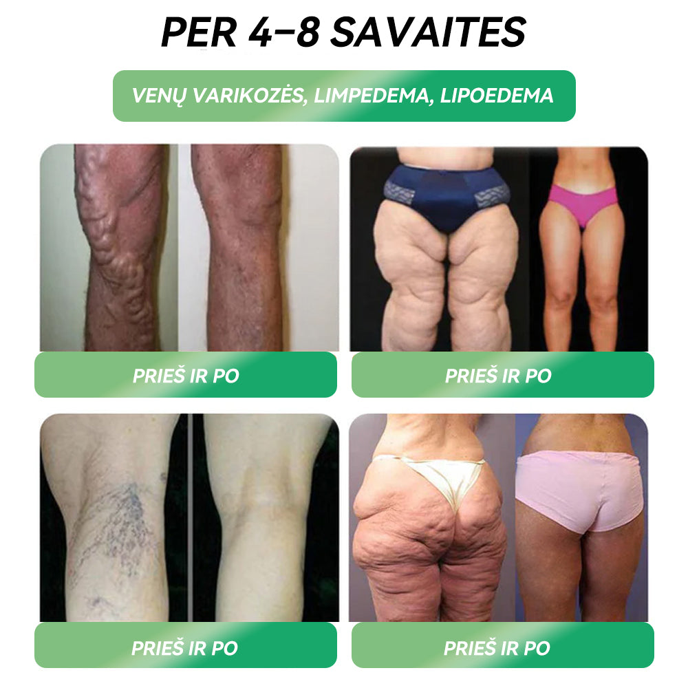 💦Matomi rezultatai per 7 dienas ✔𝑂𝑓𝑖𝑐𝑖𝑎𝑙𝑖 𝑝𝑎𝑣𝑦𝑧𝑑𝑖𝑛ė 𝑝𝑎𝑟𝑑𝑢𝑜𝑡𝑢𝑣ė🇬🇧𝑆𝑇𝐷𝐸𝐼® 𝐺𝐿𝑃-1 𝑆𝑣𝑜𝑟𝑖𝑜 𝑛𝑒𝑡𝑒𝑘𝑖𝑚𝑎𝑠 Ž𝑜𝑑𝑖𝑛𝑖𝑠 𝑠𝑝𝑟𝑒𝑛𝑑𝑖𝑚𝑎𝑠 - 👨‍🔬𝑁𝑢𝑡𝑢𝑘𝑖𝑚𝑎𝑠, š𝑖𝑟𝑑𝑖𝑒𝑠 𝑖𝑟 𝑘𝑟𝑎𝑢𝑗𝑎𝑔𝑦𝑠𝑙𝑖ų 𝑙𝑖𝑔𝑜𝑠, 𝑑𝑖𝑎𝑏𝑒𝑡𝑎𝑠, 𝑚𝑖𝑒𝑔𝑜 𝑎𝑝𝑛ė𝑗𝑎, 𝑠ą𝑛𝑎𝑟𝑖ų 𝑝𝑟𝑜𝑏𝑙𝑒𝑚𝑜𝑠 𝑖𝑟 𝑘𝑡.